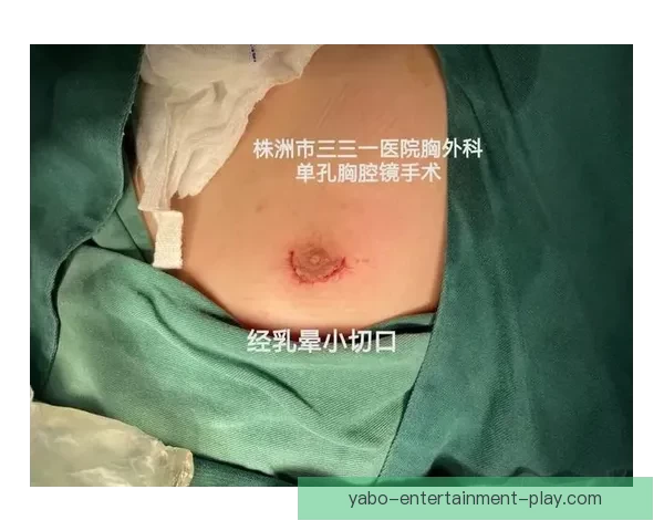 坎宁安气胸康复持续推进 活塞计划一周后复查评估